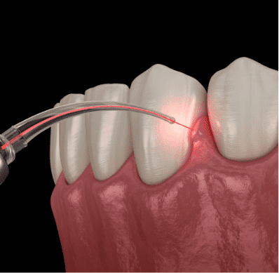 Routine dental care in Phoenix, AZ